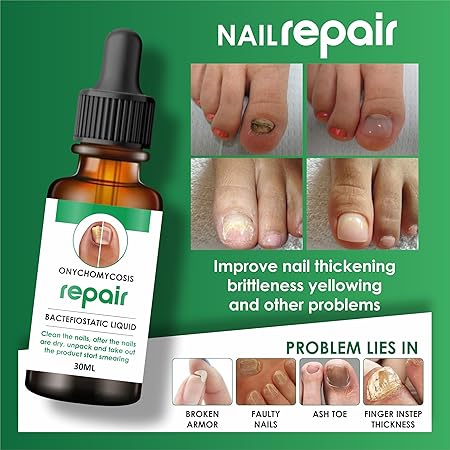 Buy 1 Get 1 Free! Nail Serum for Complete Nail Protection
